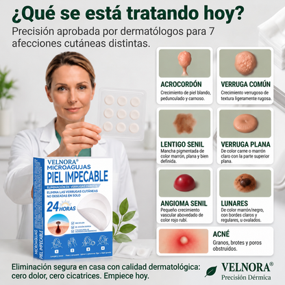 🍔🧃𝑻𝒊𝒆𝒏𝒅𝒂 𝑶𝒇𝒊𝒄𝒊𝒂𝒍 | 𝐕𝐄𝐋𝐍𝐎𝐑𝐀® 🌿 𝑀𝑖𝑐𝑟𝑜𝑎𝑔𝑢𝑗𝑎𝑠 𝑃𝑖𝑒𝑙 𝐼𝑚𝑝𝑒𝑐𝑎𝑏𝑙𝑒 𝐸𝑙𝑖𝑚𝑖𝑛𝑎𝑐𝑖ó𝑛 𝐷𝑒 𝑉𝑒𝑟𝑟𝑢𝑔𝑎𝑠 𝑃𝑎𝑟𝑐ℎ𝑒 (𝑃𝑎𝑟𝑎 𝑎𝑐𝑟𝑜𝑐𝑜𝑟𝑑𝑜𝑛𝑒𝑠, 𝑝𝑒𝑞𝑢𝑒ñ𝑎𝑠 𝑖𝑚𝑝𝑒𝑟𝑓𝑒𝑐𝑐𝑖𝑜𝑛𝑒𝑠 𝑐𝑢𝑡á𝑛𝑒𝑎𝑠, 𝑣𝑒𝑟𝑟𝑢𝑔𝑎𝑠, 𝑙𝑢𝑛𝑎𝑟𝑒𝑠, 𝑚𝑎𝑛𝑐ℎ𝑎𝑠 𝑑𝑒 𝑙𝑎 𝑒𝑑𝑎𝑑 𝑦 𝑝𝑟𝑜𝑏𝑙𝑒𝑚𝑎𝑠 𝑑𝑒 𝑝𝑖𝑔𝑚𝑒𝑛𝑡𝑎𝑐𝑖ó𝑛.)