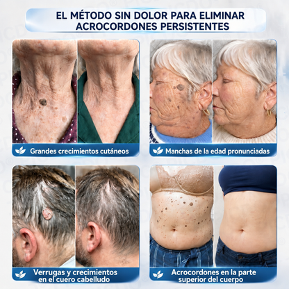 🎉👛𝐄𝐋𝐀𝐕𝐘𝐑𝐀® 𝑪𝒓𝒆𝒎𝒂 𝑩𝒐𝒓𝒓𝒂𝒅𝒐𝒓𝒂 𝒅𝒆 𝑨𝒄𝒓𝒐𝒄𝒐𝒓𝒅𝒐𝒏𝒆𝒔 𝒚 𝑴𝒂𝒏𝒄𝒉𝒂𝒔 𝒆𝒏 7 𝑫í𝒂𝒔👩‍⚕️ (𝐹ó𝑟𝑚𝑢𝑙𝑎 𝑠𝑖𝑛 𝑑𝑜𝑙𝑜𝑟 𝑛𝑖 𝑐𝑖𝑐𝑎𝑡𝑟𝑖𝑐𝑒𝑠)
