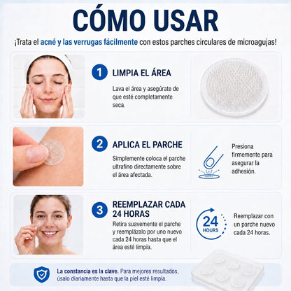 🍔🧃𝑻𝒊𝒆𝒏𝒅𝒂 𝑶𝒇𝒊𝒄𝒊𝒂𝒍 | 𝐕𝐄𝐋𝐍𝐎𝐑𝐀® 🌿 𝑀𝑖𝑐𝑟𝑜𝑎𝑔𝑢𝑗𝑎𝑠 𝑃𝑖𝑒𝑙 𝐼𝑚𝑝𝑒𝑐𝑎𝑏𝑙𝑒 𝐸𝑙𝑖𝑚𝑖𝑛𝑎𝑐𝑖ó𝑛 𝐷𝑒 𝑉𝑒𝑟𝑟𝑢𝑔𝑎𝑠 𝑃𝑎𝑟𝑐ℎ𝑒 (𝑃𝑎𝑟𝑎 𝑎𝑐𝑟𝑜𝑐𝑜𝑟𝑑𝑜𝑛𝑒𝑠, 𝑝𝑒𝑞𝑢𝑒ñ𝑎𝑠 𝑖𝑚𝑝𝑒𝑟𝑓𝑒𝑐𝑐𝑖𝑜𝑛𝑒𝑠 𝑐𝑢𝑡á𝑛𝑒𝑎𝑠, 𝑣𝑒𝑟𝑟𝑢𝑔𝑎𝑠, 𝑙𝑢𝑛𝑎𝑟𝑒𝑠, 𝑚𝑎𝑛𝑐ℎ𝑎𝑠 𝑑𝑒 𝑙𝑎 𝑒𝑑𝑎𝑑 𝑦 𝑝𝑟𝑜𝑏𝑙𝑒𝑚𝑎𝑠 𝑑𝑒 𝑝𝑖𝑔𝑚𝑒𝑛𝑡𝑎𝑐𝑖ó𝑛.)